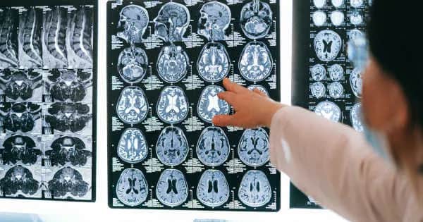 Jak gra w szachy wpłynie na mózg? Odkryj niesamowite korzyści dla rozwoju poznawczego, emocjonalnego i społecznego